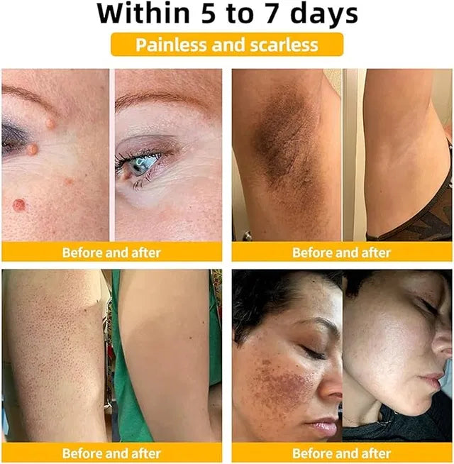 Zidella Skin Lighting Blemish Cream 50g