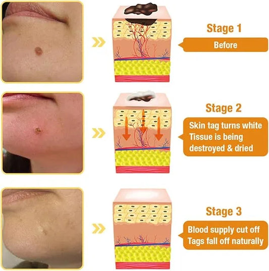 Zidella Skin Lighting Blemish Cream 50g